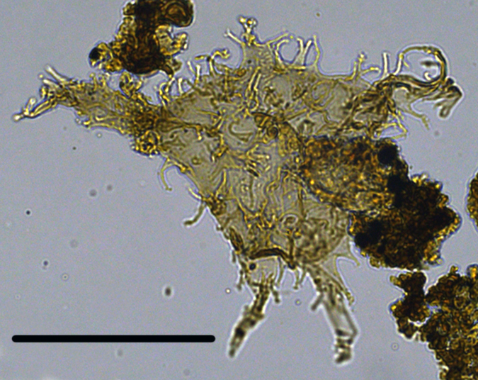 Apectodinium augustum PAau27X3101103230970a.jpg